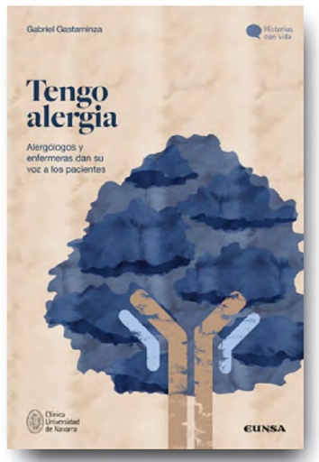 Tengo alergia