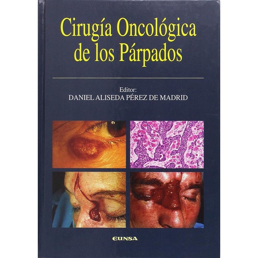 [9788431317201] Cirugía oncológica de los párpados